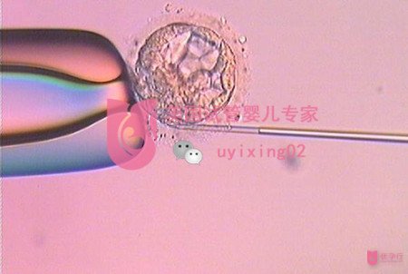 生命的誕生如此神奇｜較新美國試管嬰兒過程詳解